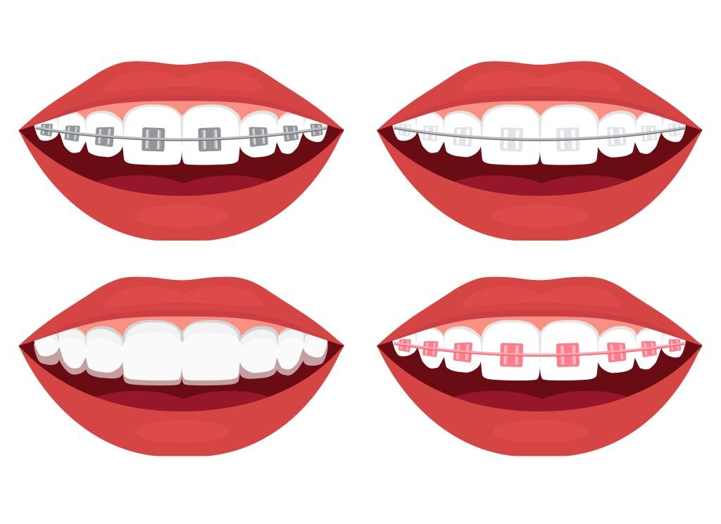 orthodontics in red hill