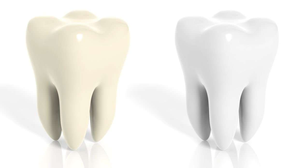 teeth whitening in red hill